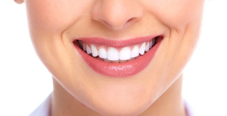 Smiling with dental implants